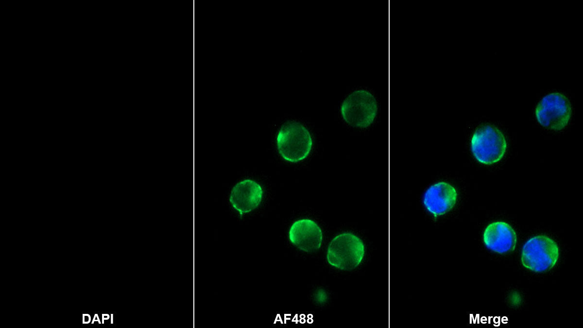 Cluster Of Differentiation 8b (CD8b) Monoclonal Antibody - image 2