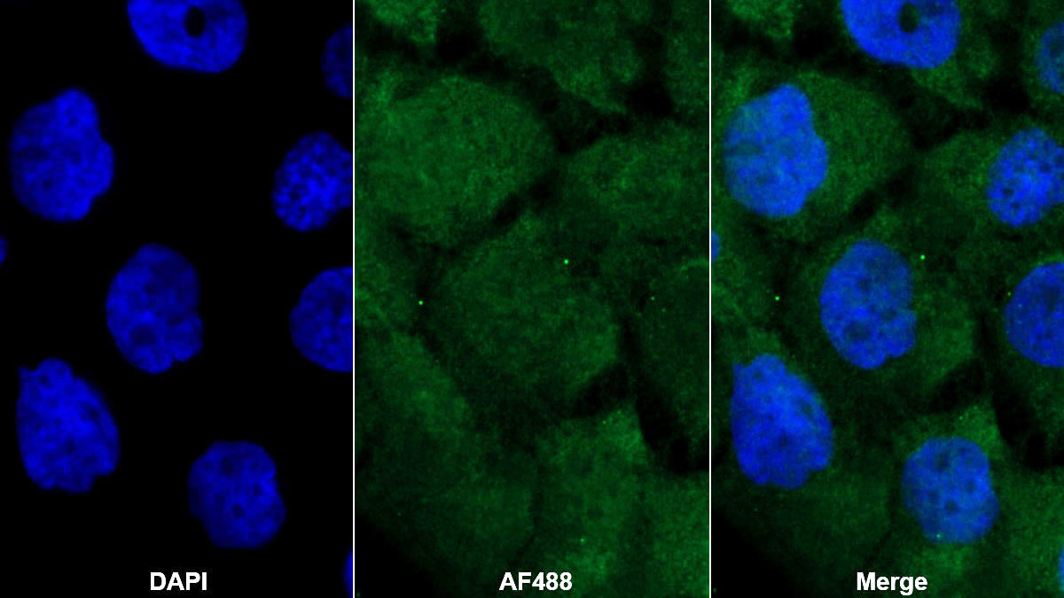 GATA Binding Protein 3 (GATA3) Monoclonal Antibody - image 2