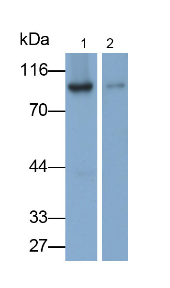 Glycogen Phosphorylase, Liver (PYGL) Monoclonal Antibody - image 2