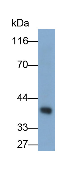Arginase (ARG) Monoclonal Antibody - image 2