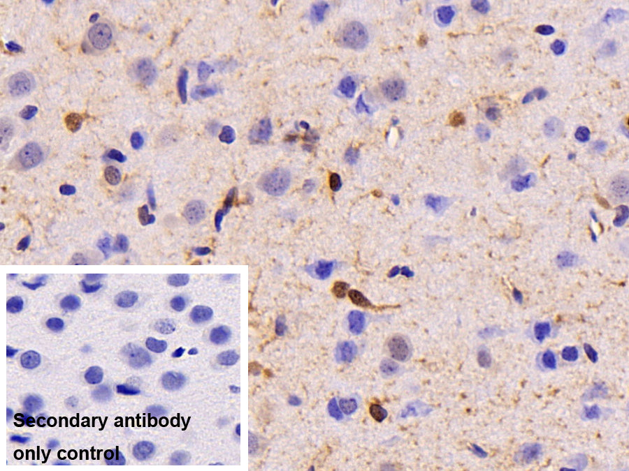 DAB staining on IHC-P; Sample: Rat Spinal cord Tissue; Primary Ab: 30ug/ml Mouse Anti-Rat CK-BB Antibody; Control: Used PBS instead of primary antibody; Second Ab: 2ug/ml HRP-Linked Caprine Anti-Mouse IgG Polyclonal Antibody