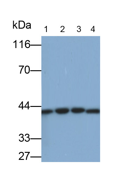 Creatine Kinase B (CK-BB) Monoclonal Antibody - image 4