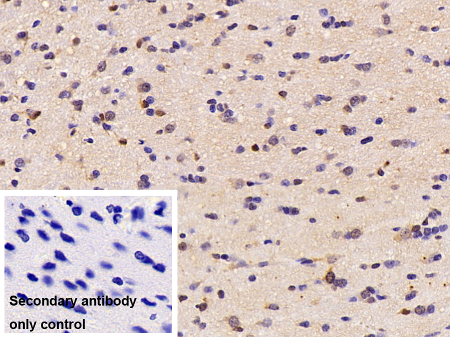 DAB staining on IHC-P; Sample: Rat Cerebellum Tissue; Primary Ab: 30ug/ml Mouse Anti-Rat CK-BB Antibody; Control: Used PBS instead of primary antibody; Second Ab: 2ug/ml HRP-Linked Caprine Anti-Mouse IgG Polyclonal Antibody