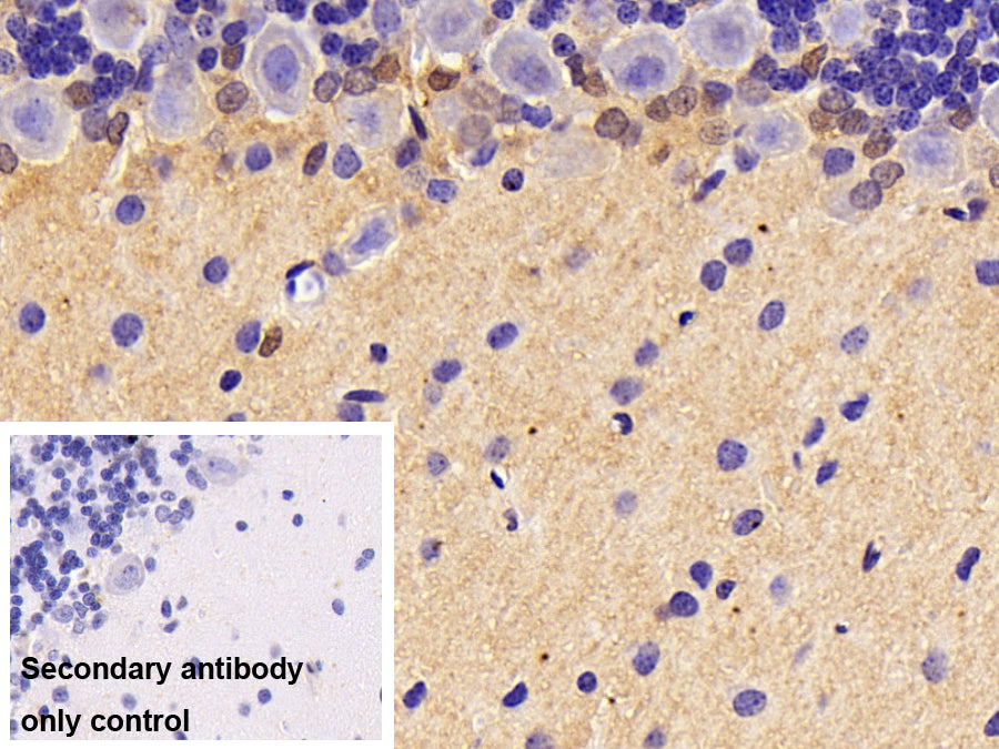 DAB staining on IHC-P; Sample: Rat Spinal cord Tissue; Primary Ab: 30ug/ml Mouse Anti-Rat CK-BB Antibody; Control: Used PBS instead of primary antibody; Second Ab: 2ug/ml HRP-Linked Caprine Anti-Mouse IgG Polyclonal Antibody