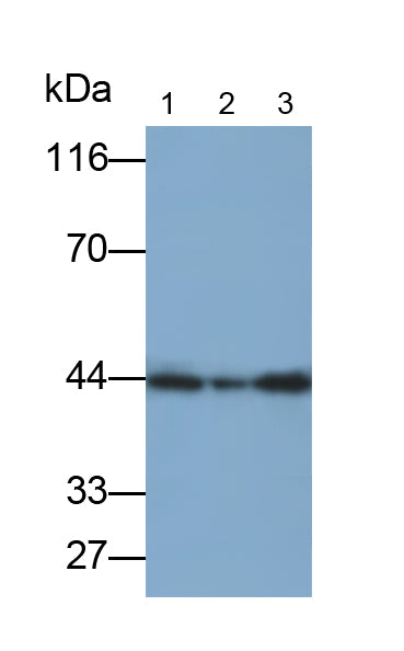 Creatine Kinase B (CK-BB) Monoclonal Antibody - image 5