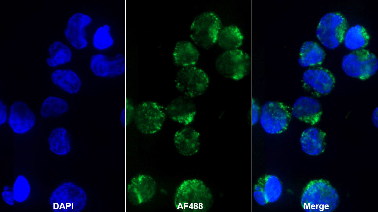 Interleukin 8 (IL8) Monoclonal Antibody - image 2