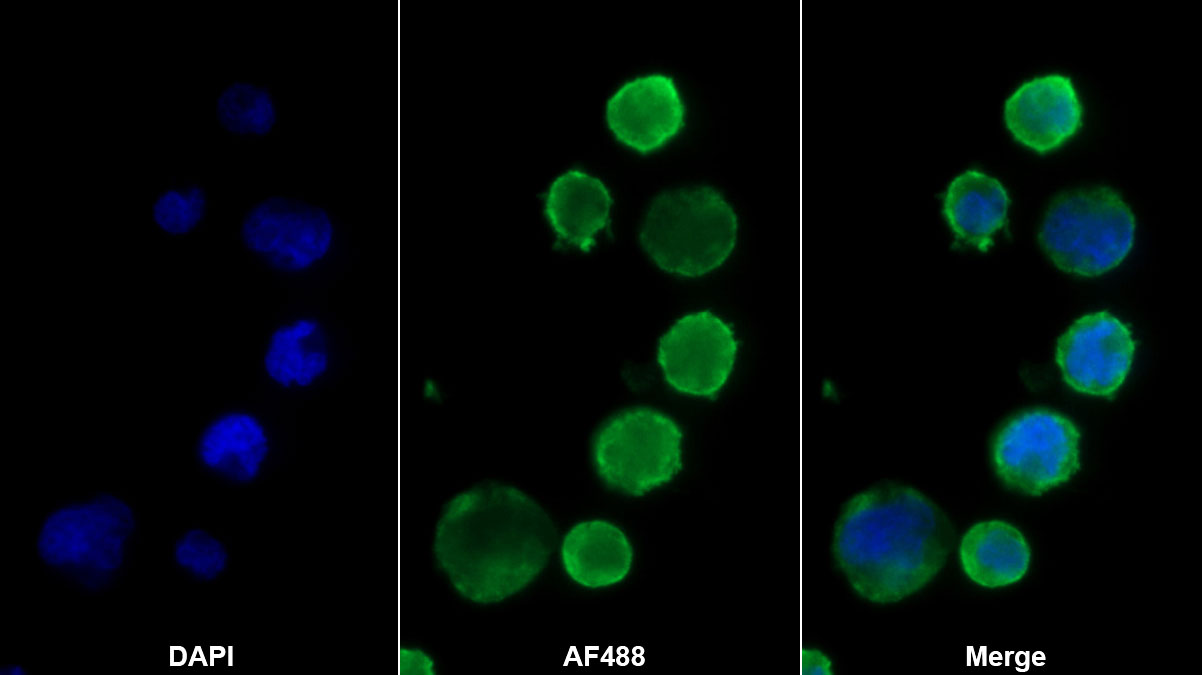 Bone Marrow Stromal Cell Antigen 1 (BST1) Monoclonal Antibody - image 2