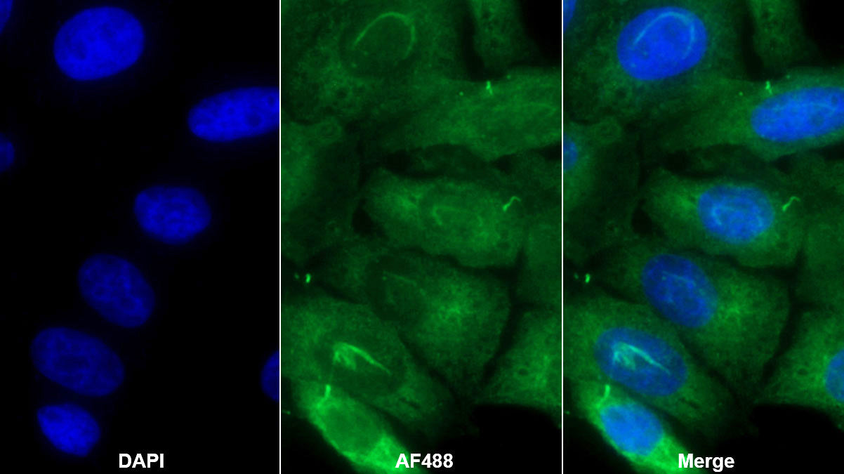 Transforming Growth Factor Beta 3 (TGFb3) Monoclonal Antibody - image 2
