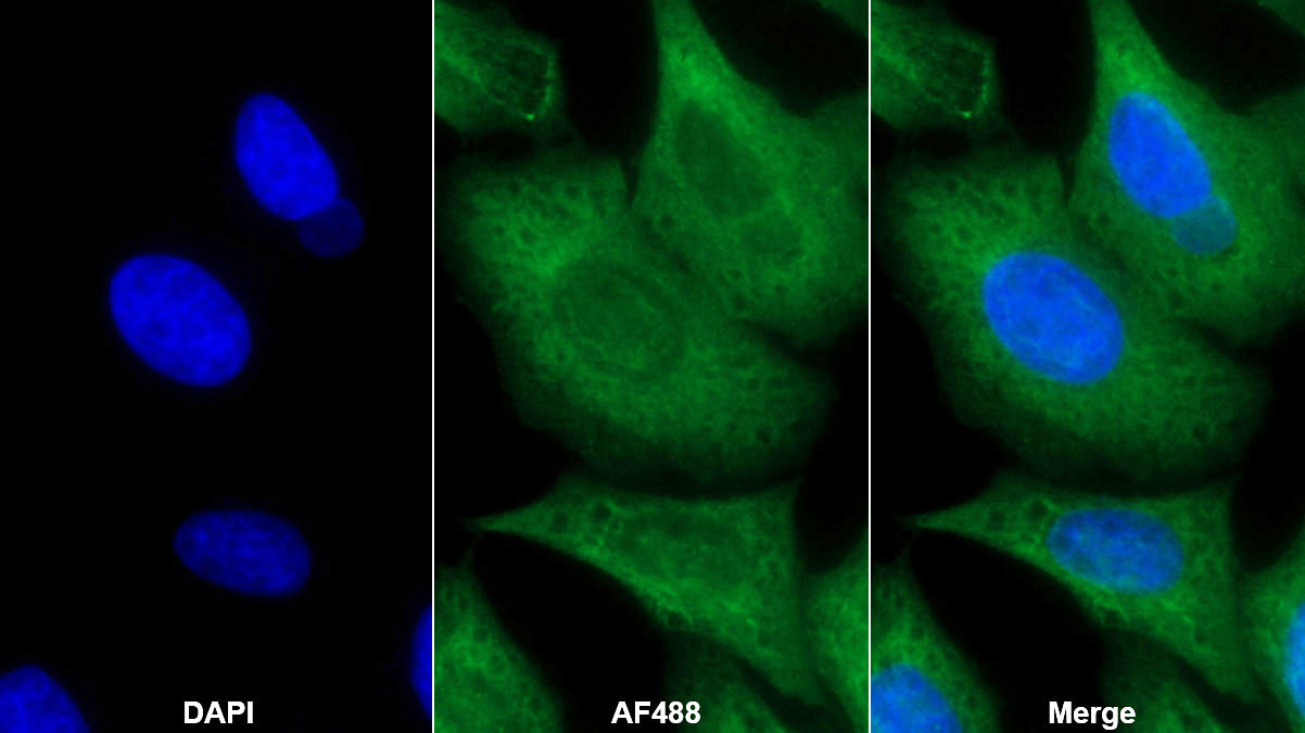 Transforming Growth Factor Beta 3 (TGFb3) Monoclonal Antibody - image 2