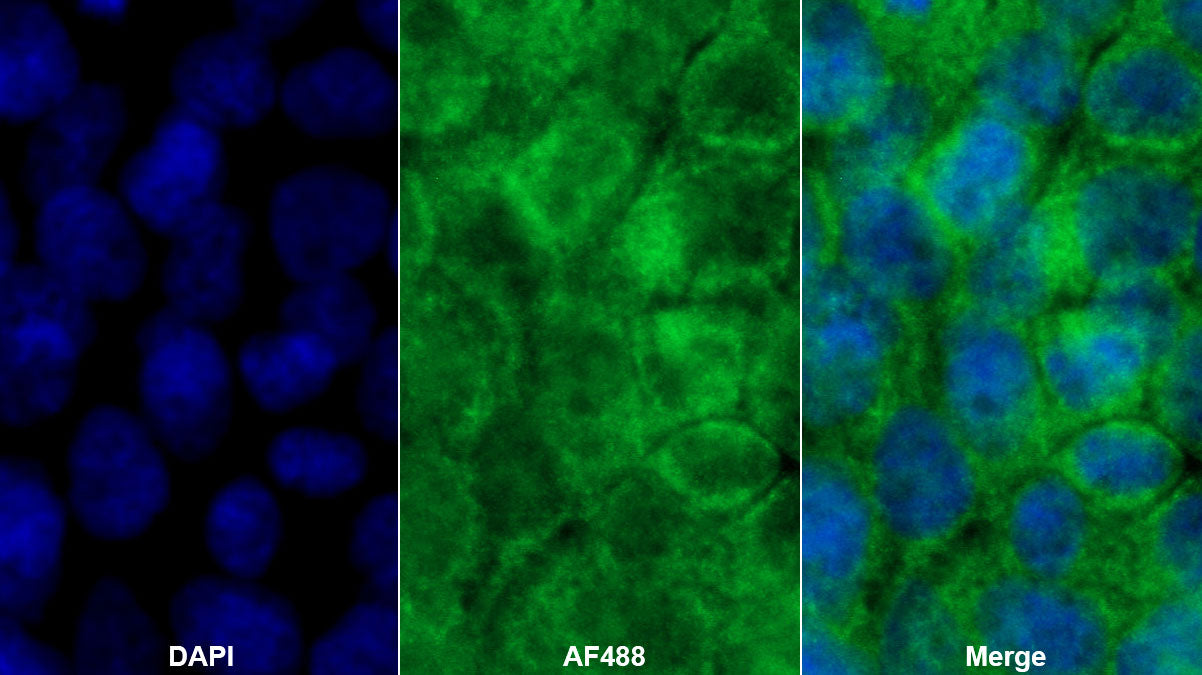 Transforming Growth Factor Alpha (TGFa) Monoclonal Antibody - image 2