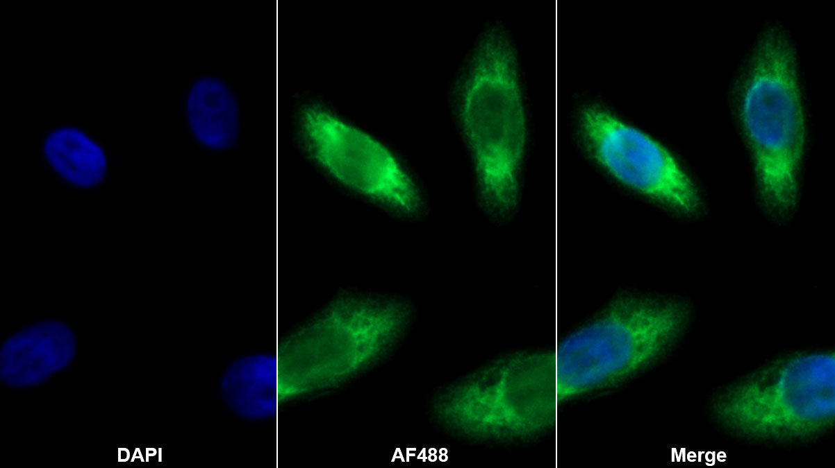 Receptor Activator Of Nuclear Factor Kappa B Ligand (RANkL) Monoclonal Antibody - image 2