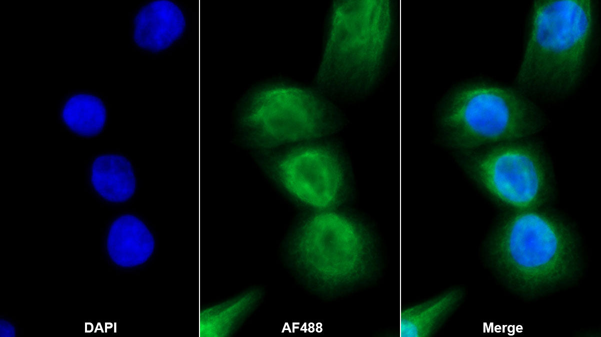 Receptor Activator Of Nuclear Factor Kappa B Ligand (RANkL) Monoclonal Antibody - image 2