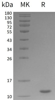 Recombinant Human UBB