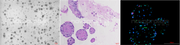 Recombinant Human KGF