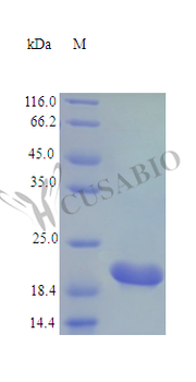Recombinant Rat Cardiotrophin-1 protein (Ctf1) (Active)