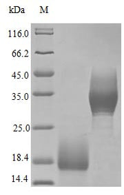 Recombinant Human Trefoil factor 3 protein (TFF3) (Active)