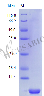 Recombinant Human C-C motif chemokine 14 protein (CCL14), partial (Active)