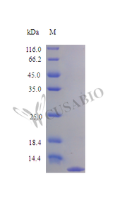 Recombinant Human Tumor necrosis factor receptor superfamily member 12A protein (TNFRSF12A), partial (Active)