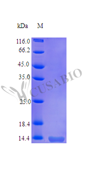 Recombinant Human Tumor necrosis factor receptor superfamily member 10B (TNFRSF10B), partial (Active)