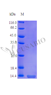 Recombinant Human Tumor necrosis factor receptor superfamily member 10B (TNFRSF10B), partial (Active)