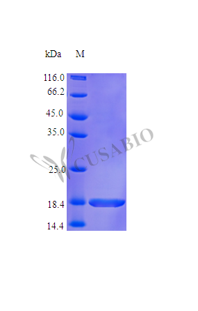 Recombinant Human Tumor necrosis factor receptor superfamily member 11A protein (TNFRSF11A), partial (Active)