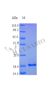 Recombinant Human Fibroblast growth factor 4 protein (FGF4), partial (Active)