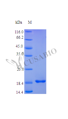 Recombinant Human Fibroblast growth factor 4 protein (FGF4), partial (Active)