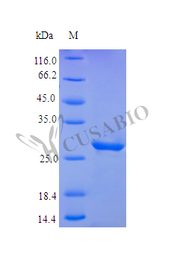 Recombinant Human Insulin-like growth factor-binding protein 3 protein (IGFBP3) (Active)