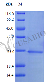 Recombinant Human Interferon alpha-1/13 (IFNA1) (Active)