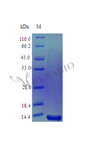 Recombinant Human Midkine protein (MDK) (Active)