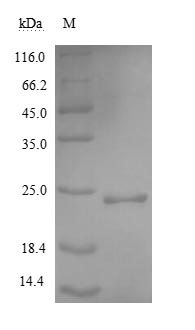 Recombinant Human Noggin protein (NOG) (Active)