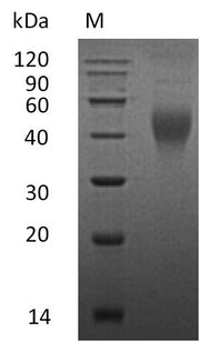 Recombinant Mouse Macrophage colony-stimulating factor 1 (Csf1), partial (Active)