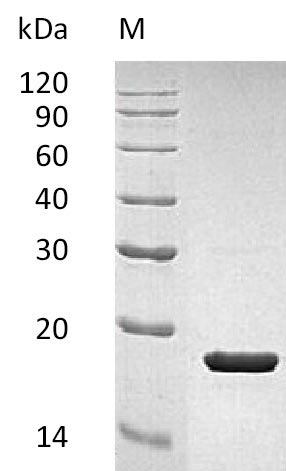 Recombinant Human Interleukin-1 receptor antagonist protein (IL1RN) (Active)