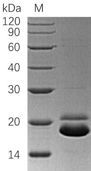 Recombinant Human Tumor necrosis factor receptor superfamily member 10B (TNFRSF10B), partial (Active)