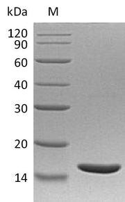 Recombinant Human Lymphotoxin-alpha (LTA) (Active)