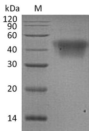 Recombinant Human Low affinity immunoglobulin gamma Fc region receptor III-A (FCGR3A), partial (Active)