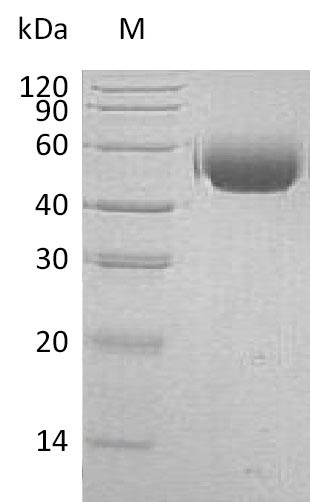 Recombinant Human Tyrosine-protein phosphatase non-receptor type substrate 1 (SIRPA), partial (Active)
