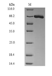 Recombinant Mouse Serum albumin (Alb)