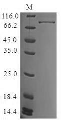 Recombinant Human Tyrosine-protein kinase BTK (BTK)