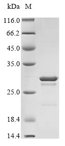 Recombinant Human Ciliary neurotrophic factor (CNTF)