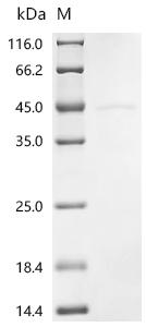 Recombinant Human Casein kinase I isoform delta (CSNK1D )