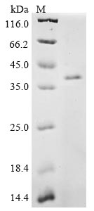 Recombinant Mouse CCN family member 1 (Ccn1)