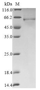 Recombinant Human Protein DEK (DEK)