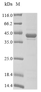 Recombinant Mouse Dihydroorotate dehydrogenase (quinone), mitochondrial(Dhodh), partial