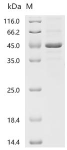 Recombinant Human Galactose-1-phosphate uridylyltransferase (GALT)