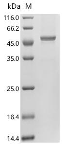 Recombinant Human Galactose-1-phosphate uridylyltransferase (GALT)