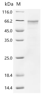 Recombinant Human Lysosomal acid glucosylceramidase (GBA1)
