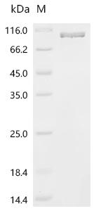 Recombinant Mouse Heat shock protein HSP 90-beta (Hsp90ab1)