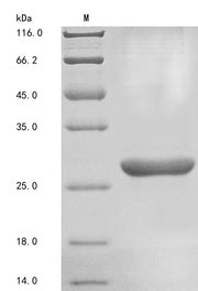 Recombinant Human Basement membrane-specific heparan sulfate proteoglycan core protein (HSPG2), partial
