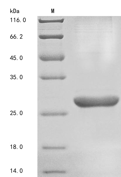 Recombinant Human Basement membrane-specific heparan sulfate proteoglycan core protein (HSPG2), partial
